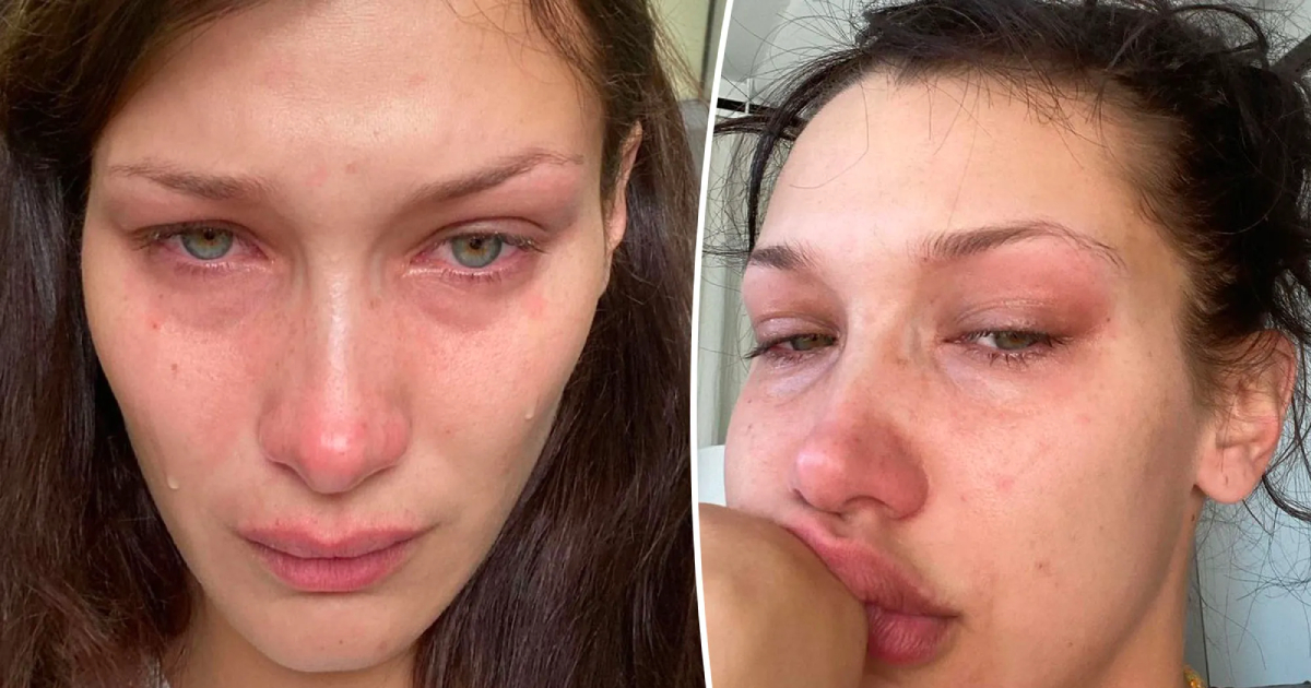 Bella Hadid opens up about her mental health struggles